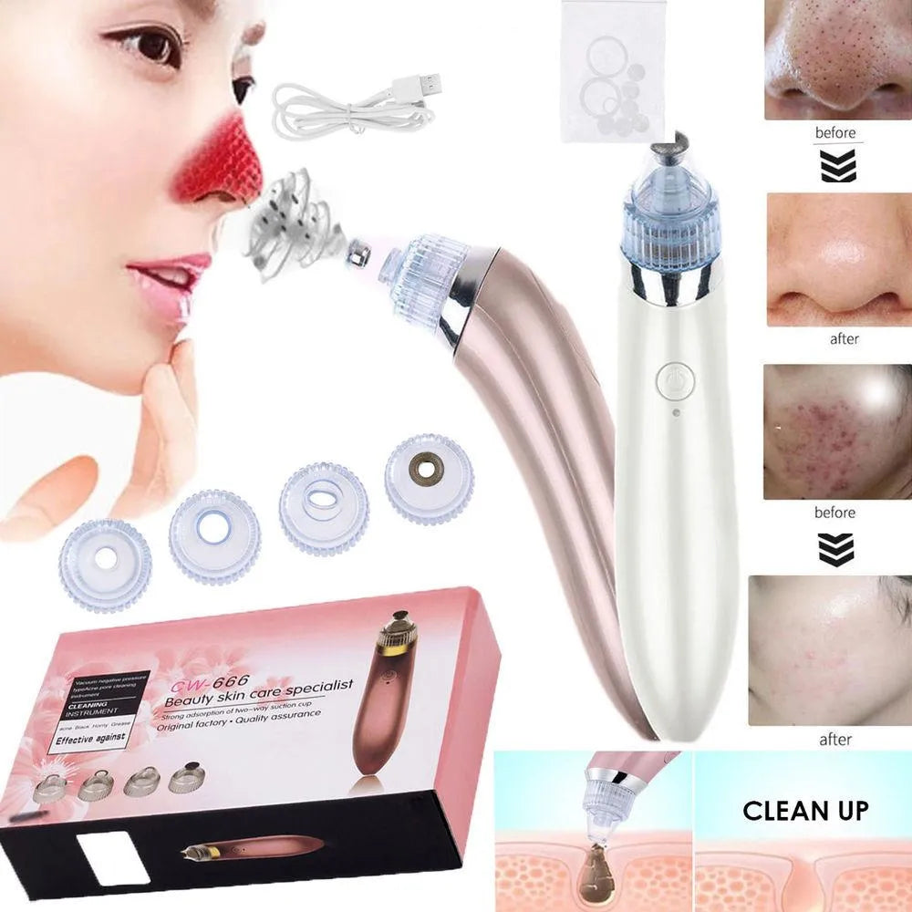 Electric Blackhead Acne Oil Remover Vacuum