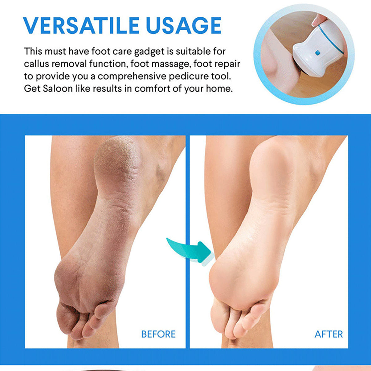 Electric Foot Grinder - souqsaving.com